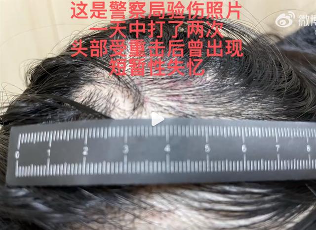 王东老婆被家暴后再次发文控诉（演员王东多次家暴）(5)