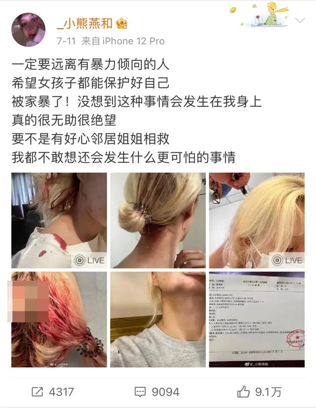 直播网红被男友家暴（男友电梯内家暴女网红）(4)