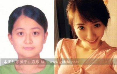 ​刘萌萌整容，张萌脸打很多玻尿酸(张檬整容整了哪些地方)