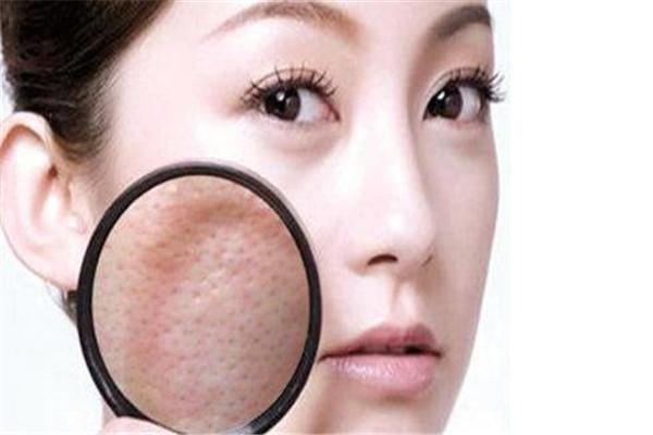 专家告诉你毛孔粗大用什么好（这5个方法比较实用）