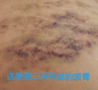 ​屈楚萧和楚梵聊天记录（屈楚萧事件后续）