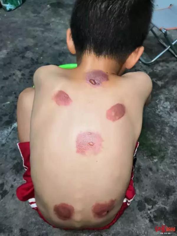 三伏贴是骗人的吗（长城评论三伏贴）(2)