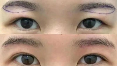 ​提眉跟切眉哪个效果好（提眉与切眉的区别）