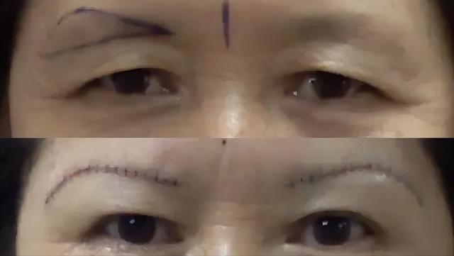 提眉跟切眉哪个效果好（提眉与切眉的区别）(2)
