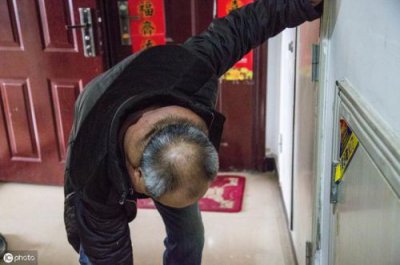 ​多发性脂肪瘤越来越多怎么办？多发性脂肪瘤是什么原因造成的