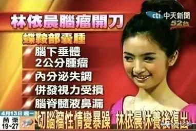 为了孩子备孕七年，直到39岁才如愿以偿，林依晨真的太难了啊