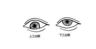 ​三白眼有什么特点   三白眼为什么被称为美人眼