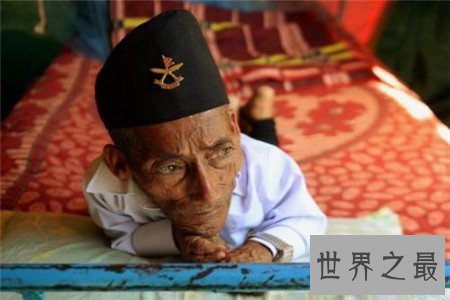 世界上最矮的人怎么可以这么矮，就连小猫小狗都会欺负他？