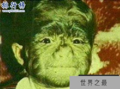 ​世界上最著名的兽孩:狼女卡玛拉 不穿衣服和猫狗为伴