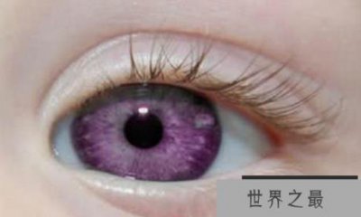 ​世界上最罕见的眼睛是最美丽的