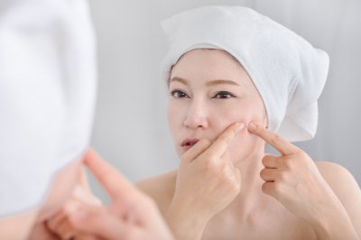 ​脓包型痘痘，老是反复 怎么处理脓包痘痘