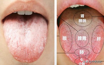 ​舌苔发白厚是什么 舌苔发白好厚