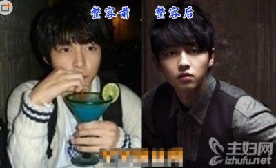 ​宋仲基整容了吗 疑似宋仲基整容前后照片对比