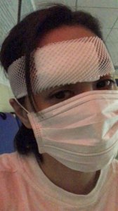 ​阿娇头部受伤照曝光 伤口长达6cm需缝合数十针
