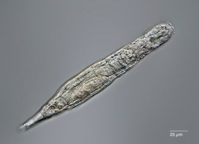 ​科学家团队成功复活在永久冻土中生活2.4万年的轮虫