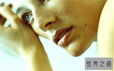 ​痣是怎么形成的？大部分都是因为人的基因原因