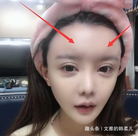 韩安冉整容失败，素颜开直播告诫网友，如今的她却变了样子