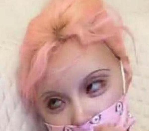 她被称为中国真人芭比，张嘴吃东西困难，最后被一张照片害惨！