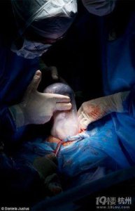 ​分娩全解析：揭秘孕妇在家与医院生孩子的风险与注意事项