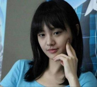 ​郑爽疑似整容失败，多次整容过程被曝光