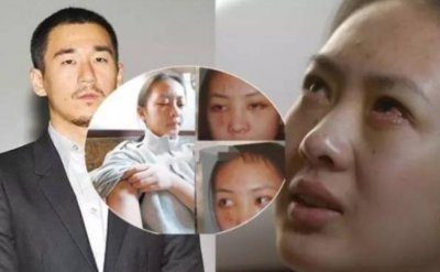 ​张默打的女演员是谁  被打后凭借三十而已完美翻身