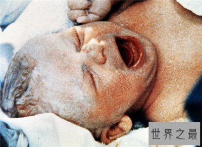 ​世界上最早的试管婴儿，时间早的让你不敢想象