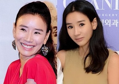 ​佩服！10位韩国女星整容前后对比，在韩国整容跟化妆一样正常？