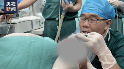 ​“我快坚持不住了！”医生为 1 岁男童吹氧，下一秒……