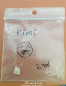 ​林志颖儿子Kimi掉牙照，小心保存儿子乳牙